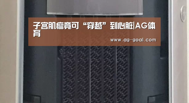 AG赛事
